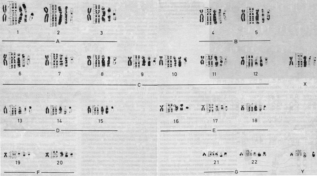 Рис. 2.8. Кариотип мужчины: хромосомы окрашены стандартным методом и методами, выявляющими характерную сегментацию. Слева направо: стандартное окрашивание; схематическое изображение рисунка сегментации; G-метод; R-метод; C-метод. (Courtesy of Dr. T. M. Schroeder-Kurth.)