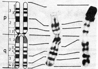 Рис. 2.10. Хромосома 1: сравнение реальной G- и R-сегментации со схематическим изображением G- и R-сегментов. (Courtesy of T. M. Schroeder-Kurth.)