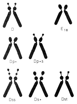 Рис. 2.14. Гетероморфизм акроцентрических маркерных хромосом групп D или G. Первый ряд: нормальные хромосомы группы D и хромосома 18 для сравнения. Второй ряд: Dp +: короткие плечи такой же длины, как короткие плечи хромосомы 18; p+s: спутники нормальных размеров на удлиненных коротких плечах. Третий ряд: D-хромосомы со структурными вариантами спутничного района, ss - двойные спутники; s + - увеличенные спутники; st - удлиненные спутничные нити [1711]