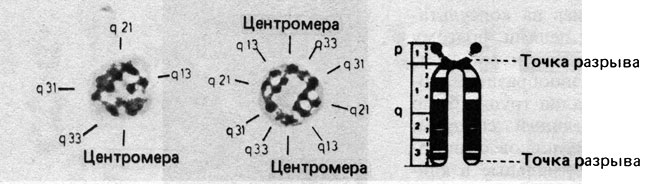 Рис. 2.53. Рисунок сегментации моноцентрической (слева) и дицентрической (справа) кольцевой хромосомы [382]