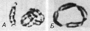 Рис. 2.54. А. Два соединенных двойных кольца из диплоидной клетки рядом с другой хромосомой 13-й пары. Б. Тетрацентрическое кольцо из тетраплоидной клетки [382]