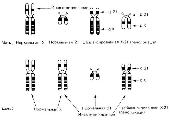 Рис. 2.75. X-дозовая компенсация у матери и дочери с разными наборами X-хромосом. У матери две транслокационные хромосомы X-21 и одна нормальная (она и инактивируется); у дочери две нормальные X-хромосомы, одна из которых инактивирована, и одна транслокационная хромосома, которая тоже инактивирована [501]